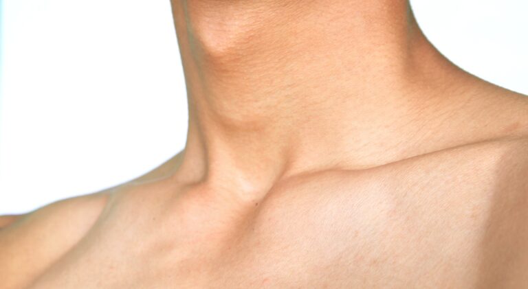 Здоров’я щитоподібної залози