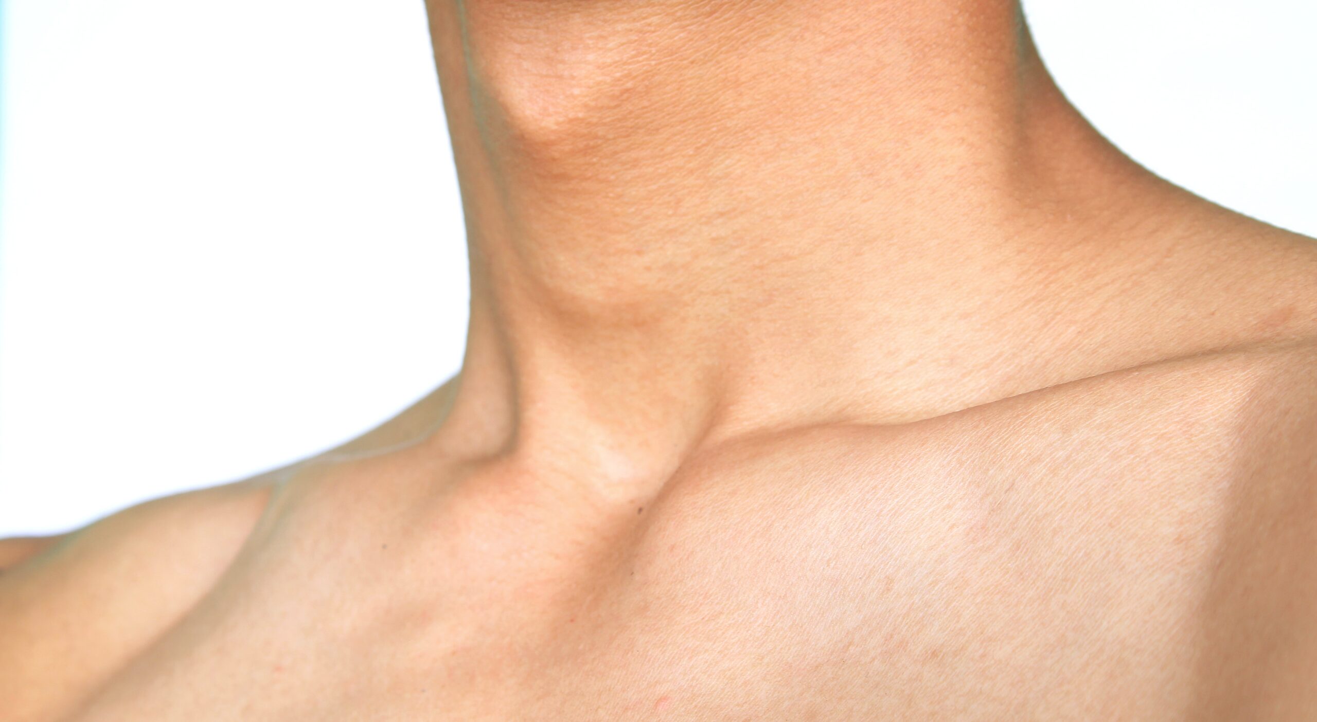 щитоподібна залоза Кропивницький